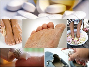 fungus of the skin of the foot folk remedies