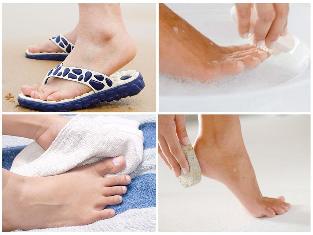 fungus of the skin of the foot prevention